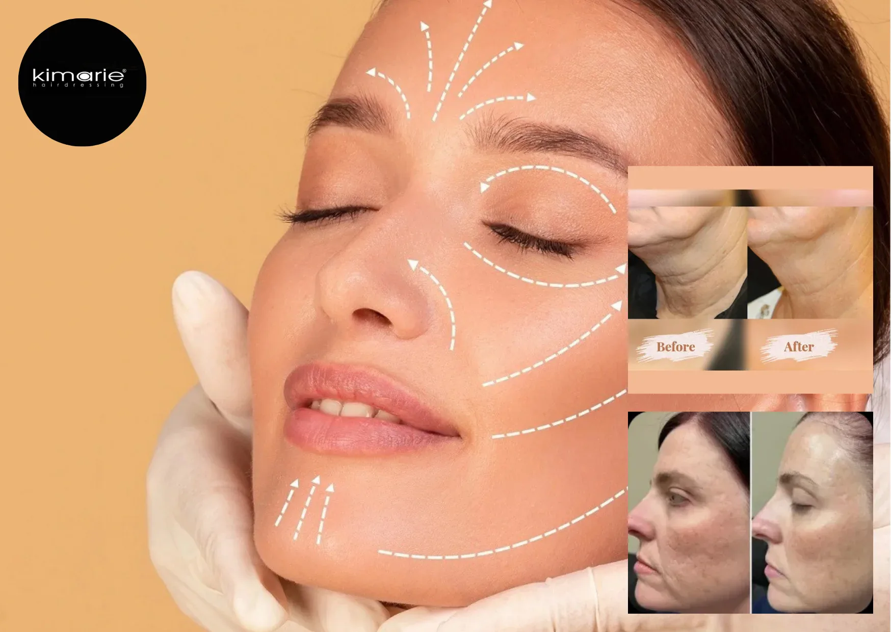 Oxygen Facial Oakville – Rejuvenate Your Skin with Expert Care Oxygen Facial Oakville – Rejuvenate Your Skin with Expert Care