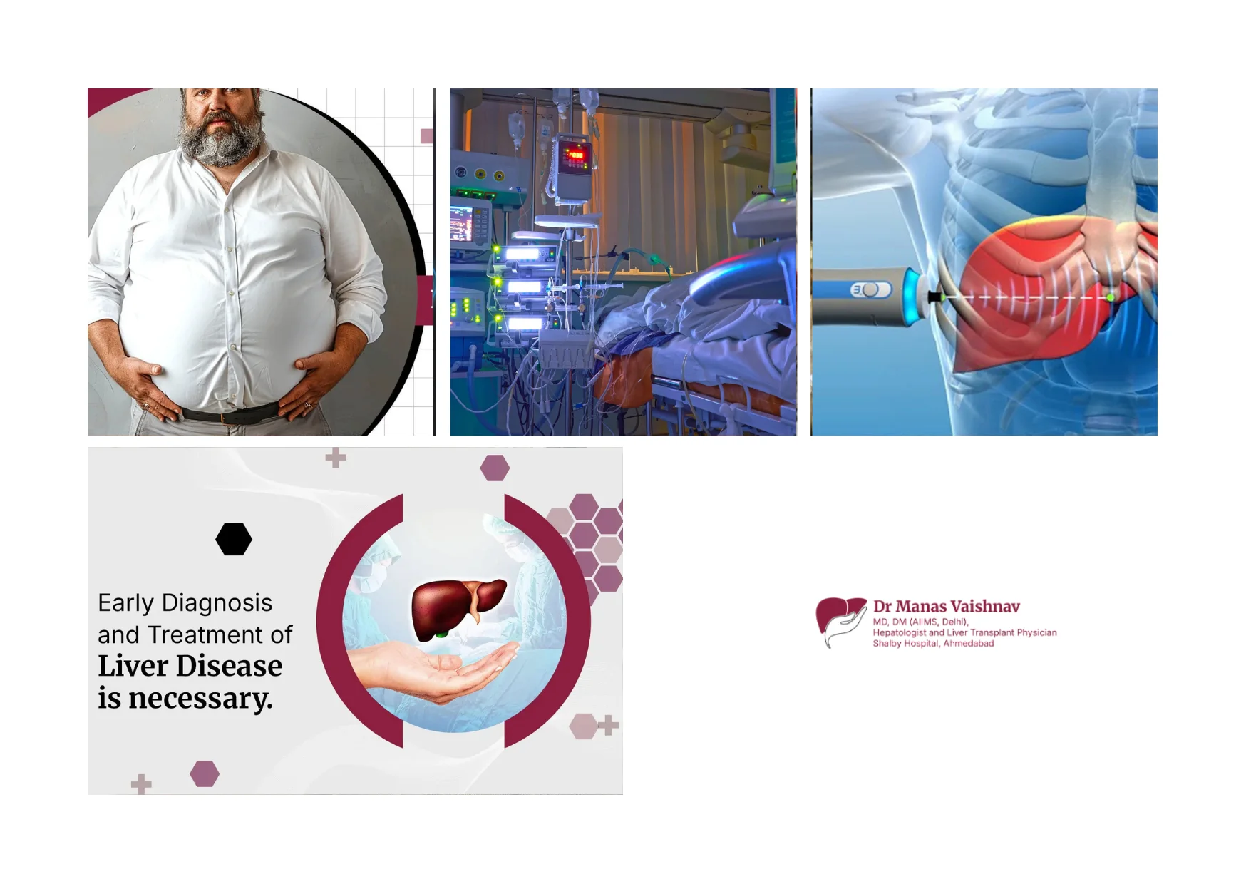 Top Best Gastroenterologist Ahmedabad for Expert Liver and GI Care Top Best Gastroenterologist Ahmedabad for Expert Liver and GI Care
